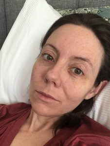 thin, woman with ulcerative colitis flare lying on bed