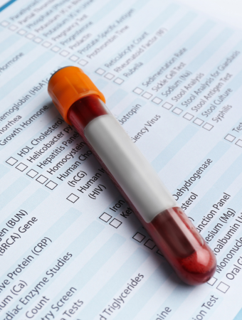 vial of blood for labs on top of lab order sheet